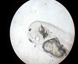 [TodoMarino.com] vídeos de huevos y prelarva de chromis viridis